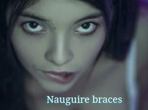 Nauguire_braces
